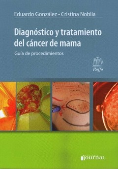 Diagnóstico Y Tratamiento Del Cáncer De Mama. Guía de Procedimientos