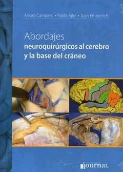 ABORDAJES NEUROQUIRURGICOS AL CEREBRO Y LA BASE DEL CRANEO