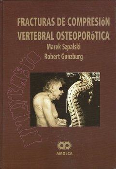 FRACTURAS DE COMPRESION VERTEBRAL OSTEOPOROTICA