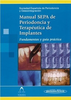 MANUAL SEPA DE PERIODONCIA Y TERAPEUTICA DE IMPLANTES