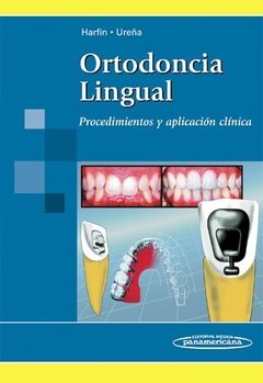 ORTODONCIA LINGUAL - Harfin