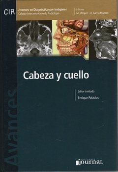 AVANCES EN DIAGNOSTICO POR IMAGENES CABEZA Y CUELLO