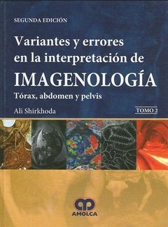 VARIANTES Y ERRORES EN LA INTERPRETACION DE IMAGENOLOGIA. TORAX, ABDOMEN Y PELVIS