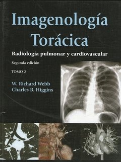 IMAGENOLOGIA TORACICA - 2 TOMOS - comprar online