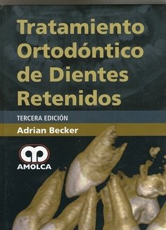 TRATAMIENTO ORTODONTICO DE DIENTES RETENIDOS