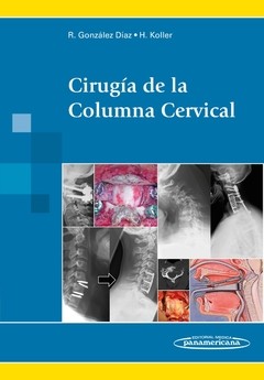 CIRUGIA DE LA COLUMNA CERVICAL