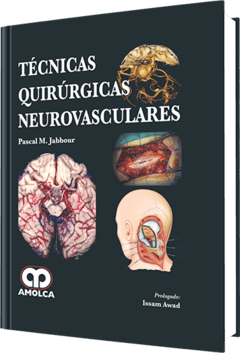 Técnicas Quirúrgicas Neurovasculares