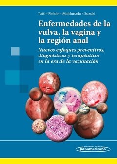 ENFERMEDADES DE LA VULVA LA VAGINA Y LA REGION ANAL