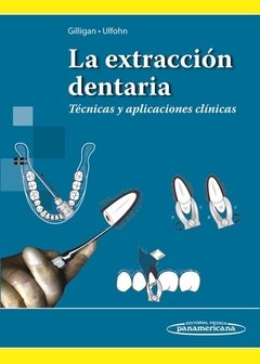 LA EXTRACCION DENTARIA