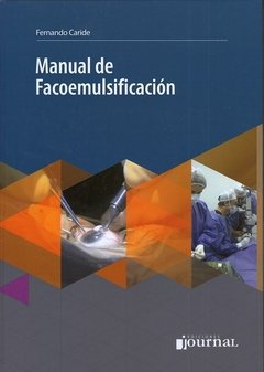 MANUAL DE FACOEMULSIFICACIÓN