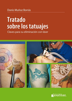 Tratado sobre tatuajes, claves para su eliminación con láser