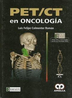 PET CT EN ONCOLOGIA