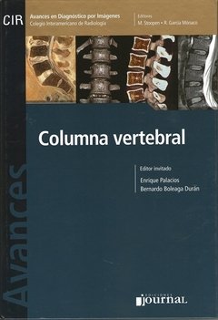 AVANCES EN DIAGNÓSTICO POR IMÁGENES: COLUMNA VERTEBRAL - Palacios - 9789871259762 