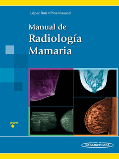 Manual de Radiología Mamaria - Lopez Ruiz