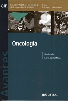 AVANCES EN DIAGNOSTICO POR IMAGENES ONCOLOGIA