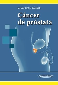 CÁNCER DE PRÓSTATA - Montes de Oca - 9789500606202