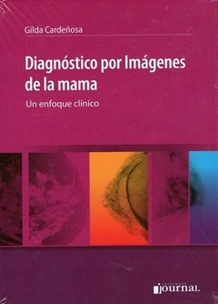 DIAGNÓSTICO POR IMÁGENES DE LA MAMA