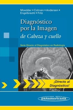 DIAGNOSTICO POR LA IMAGEN DE CABEZA Y CUELLO