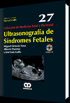 Ultrasonografía de Síndromes Fetales - Sosa / Gallo
