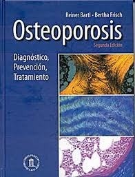 Osteoporosis. Diagnóstico, Prevención y Tratamiento - Bartl - 9788478855179