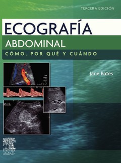 Ecografía Abdominal. Cómo, Por qué y Cúando - Bates - 9788480868976