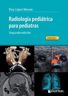 Radiología pediátrica para pediatras - 2ª Ed. - Lopez Marure - ISBN: 9789871981793