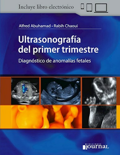 Ultrasonografía del Primer Trimestre - Diagnóstico de anomalías fetales