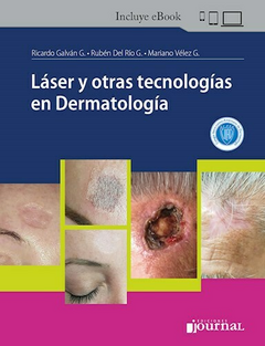 Láser y otras tecnologías en Dermatología