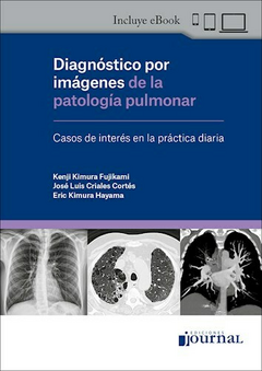 Diagnóstico por imágenes de la patología pulmonar