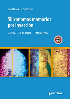 Siliconomas mamarios por inyección - Schenone - ISBN:  9789873954160 