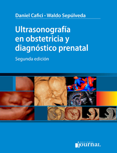 Ultrasonografía en obstetricia y diagnóstico prenatal Ed.2º - CAFICI - ISBN:  9789873954511 
