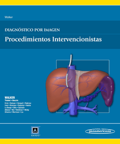 Diagnóstico por Imagen, Procedimientos intervencionistas - Walker - 9788498358063