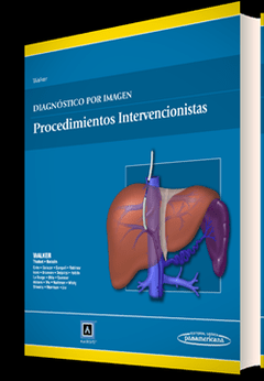 Diagnóstico por Imagen, Procedimientos intervencionistas - Walker - 9788498358063