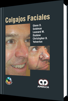 COLGAJOS FACIALES GOLDMAN