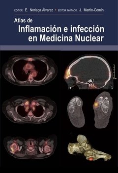 Atlas de Inflamación en Infección en Medicina Nuclear - Noriega Alvarez - Isbn: 9788478856183
