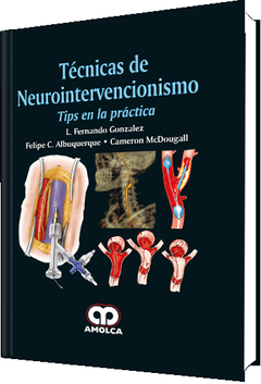Técnicas de Neurointervencionismo, Tips en la práctica - Gonzalez - 978-958-59137-1-4