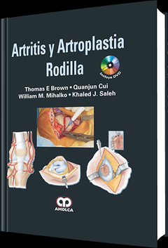 Artritis y Artroplastia de Rodilla - Brown - 978-958-755-055-9