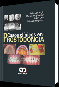 Casos Clínicos en Prostodoncia - Jahangiri - 978-958-755-059-7