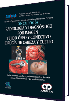 Oncología, Radiología, Diag. x Imagen, Cirugia Cabeza y Cuello - Arbellos - 978-958-5426-03-0