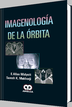 Imagenología de la Órbita - Midyett - ISBN:978-958-59113-4-5