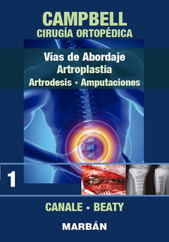 Campbell Cirugia Ortopédica T1 Vías de Abordaje Artroplastia - 9788471010650 - Canale