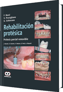 Rehabilitación Protésica, Protesis Parcial Removible - Bassi - 978-958-755-000-9