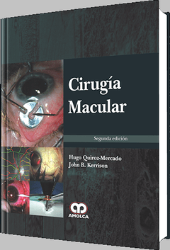 Cirugía Macular 2° Ed. - Quiroz Mercado - ISBN: 978-958-8760-64-3