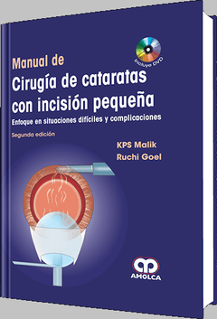 Manual de Cirugía de Cataratas con Incisión Pequeña - Malik - ISBN: 978-958-8760-07-0