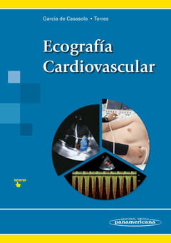 Ecografía Cardiovascular - Garcia Casasola - 9788491101284