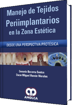 Manejo de Tejidos Periimplantarios en la Zona Estética - Becerra Santos - 978-958-5426-00-9