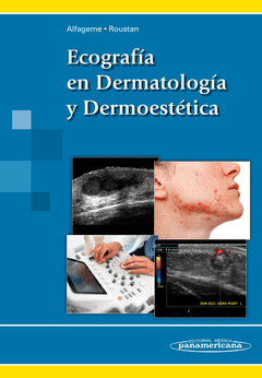 Ecografía en Dermatología y Dermoestética - Alfageme - 9788491100669