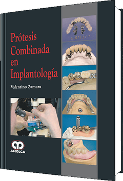 Prótesis Combinada en Implantología - Zamara - 978-958-8473-43-7