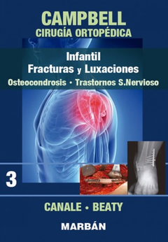 Campbell Cirugía Ortopédica T3 Infantil, Fracturas y Luxaciones, Osteocondrosis, Trastornos S. Nervioso - Canale - 9788471010919