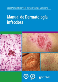 Manual de Dermatología infecciosa